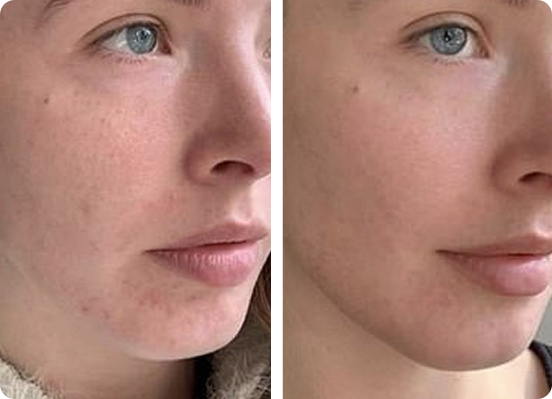 Elžbieta J: Po 3 savaičių